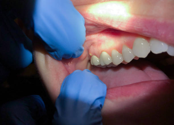 Best Pediatric Emergency Dentist in Bloomfield, NY
